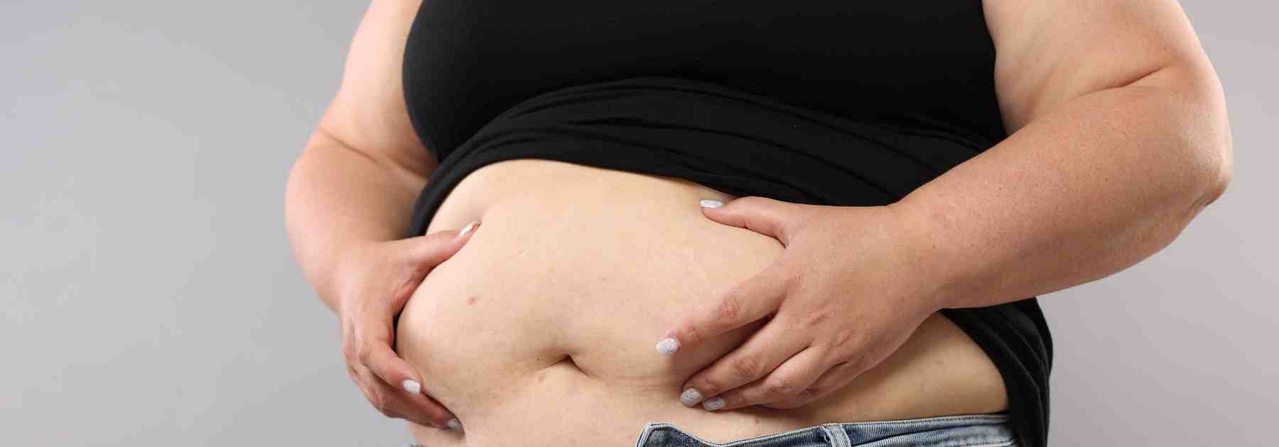 How to avoid loose skin when losing weight