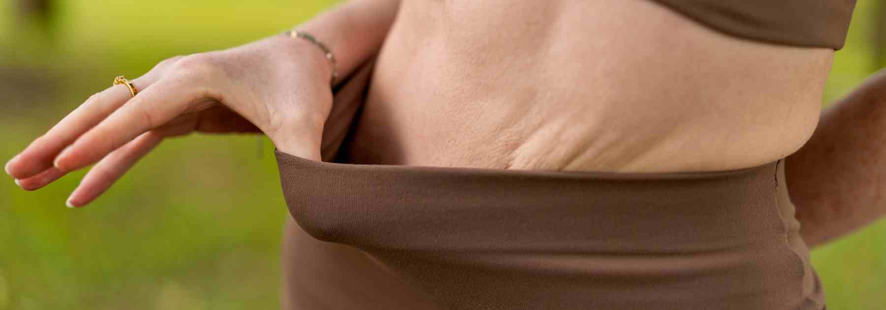 How to avoid loose skin when losing weight with medication